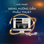 TOP 5 ĐIỀU CẦN LƯU Ý TRƯỚC KHI ĐẦU TƯ MÁY IN 3D NHA KHOA