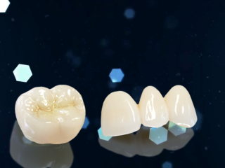 PHỤC HÌNH SỨ CERCON